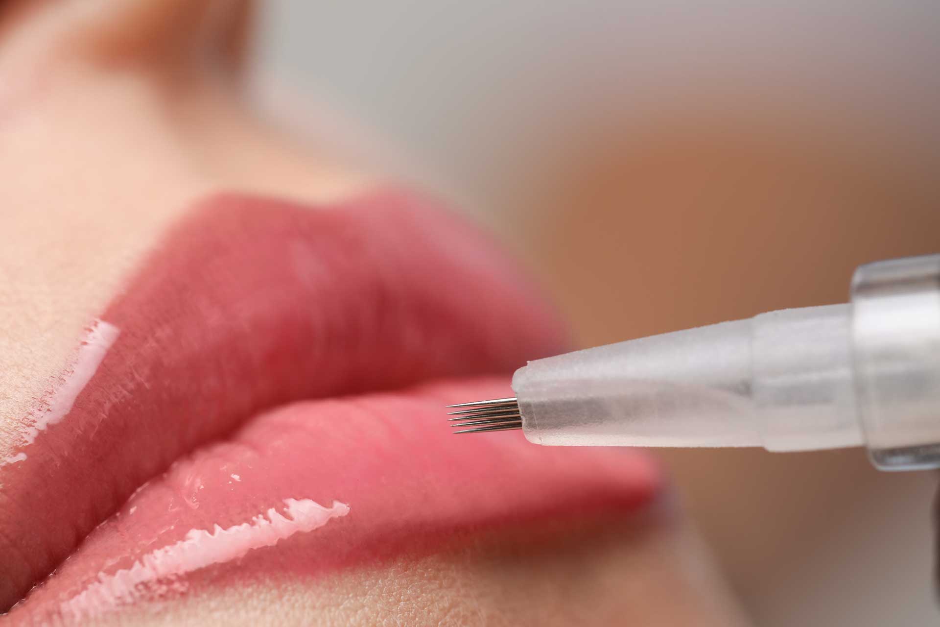 Enhances lip definition & symmetry
